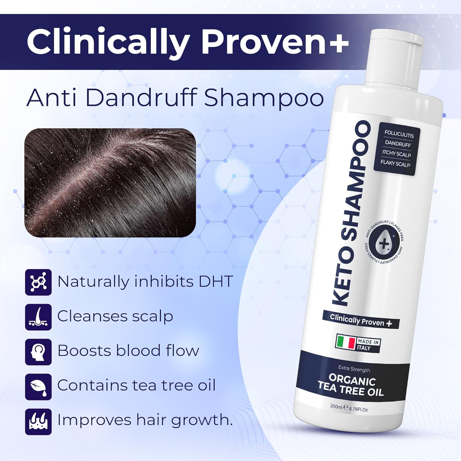 Anti Dandruff Shampoo, Sulfate Free, Anti Fungal, Medicated, Clarifying Shampoo